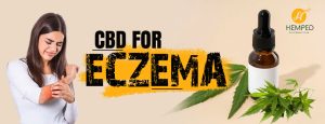 cbd for eczema